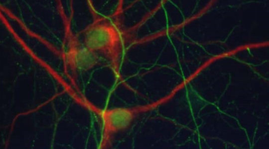 Imagen de un cultivo primario neuronal con detección del marcador de dendritas MAP2 (rojo) y del marcador de axones Neurofilament (verde). / UB